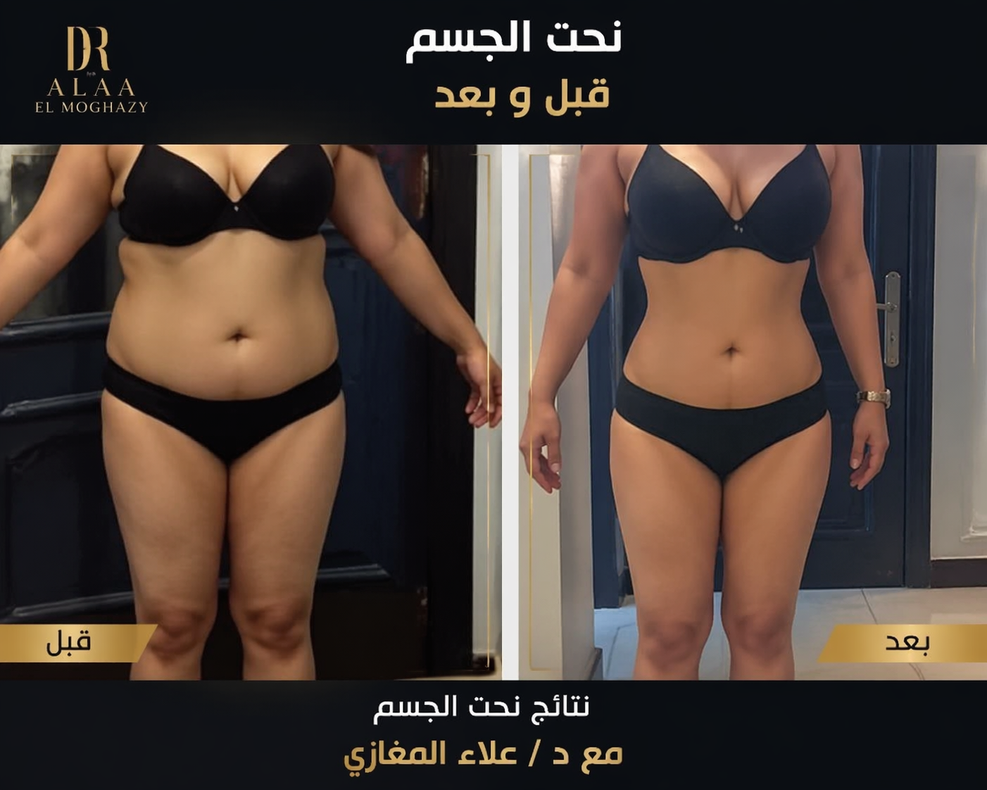 أفضل دكتور نحت الجسم