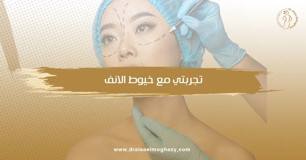 تجربتي مع خيوط الانف