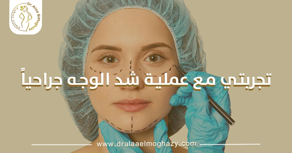 تجربتي مع عملية شد الوجه جراحياً