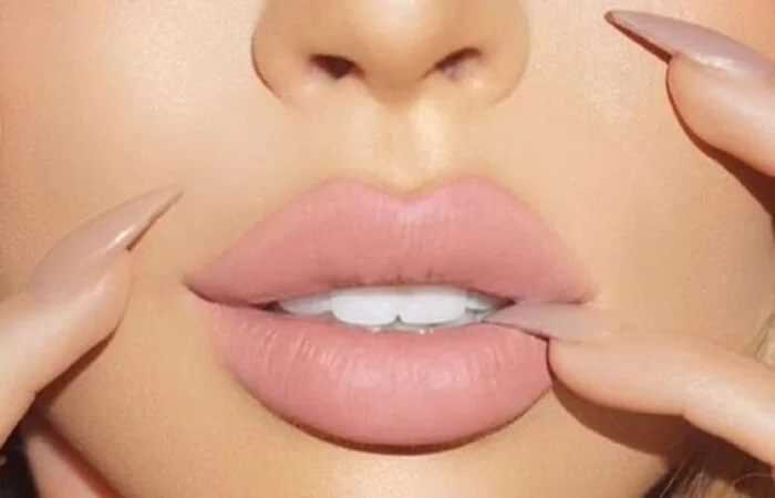 جراحات الشفاه