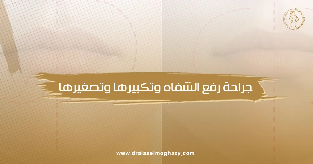 جراحة رفع الشفاه وتكبيرها وتصغيرها