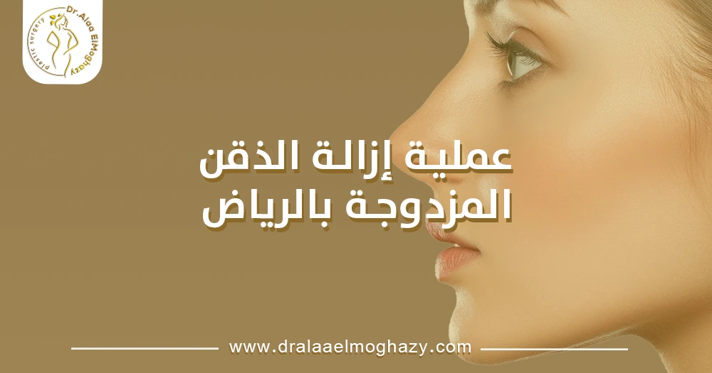 عملية إزالة الذقن المزدوجة بالرياض