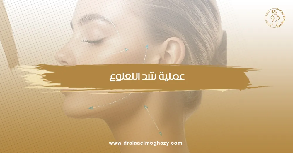 عملية شد اللغلوغ