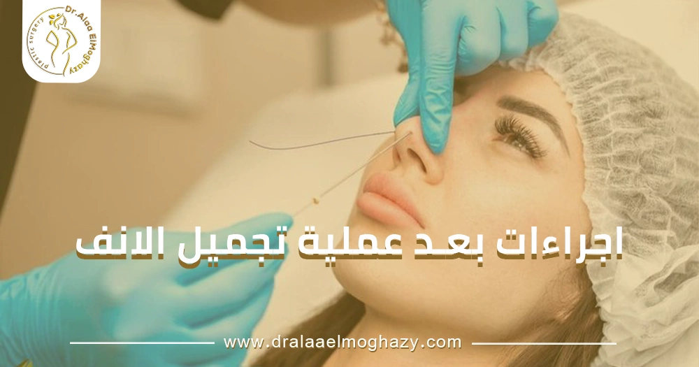 اجراءات بعد عملية تجميل الانف