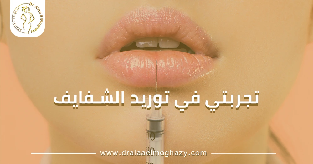 تجربتي في توريد الشفايف