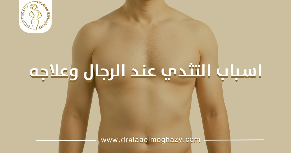 اسباب التثدي عند الرجال وعلاجه
