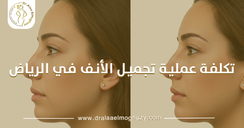 تكلفة عملية تجميل الأنف في الرياض