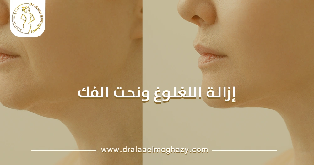إزالة اللغلوغ ونحت الفك