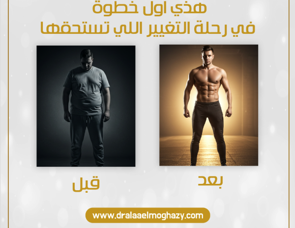 التثدي للرجال